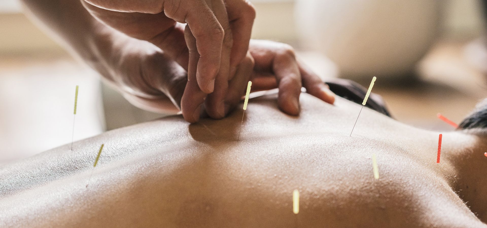 Weiterbildung Akupunktur/ Manuelle Medizin